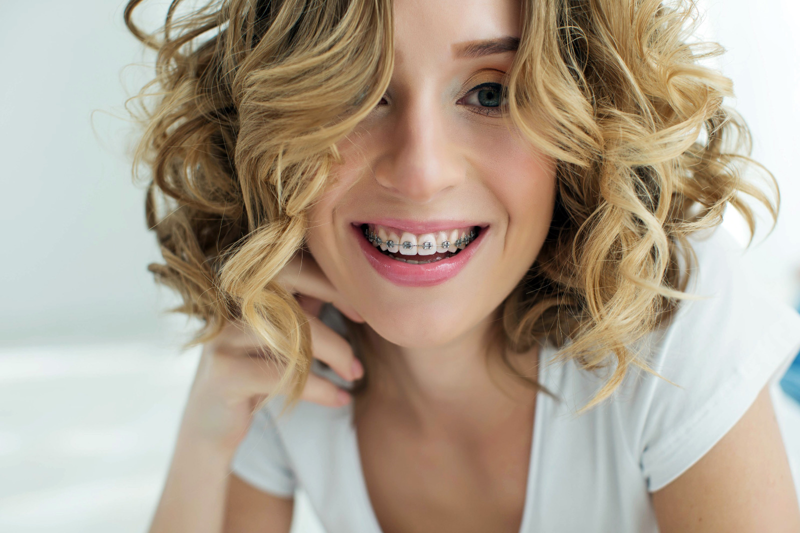 Ortodontska terapija u Dental Timu Vuković