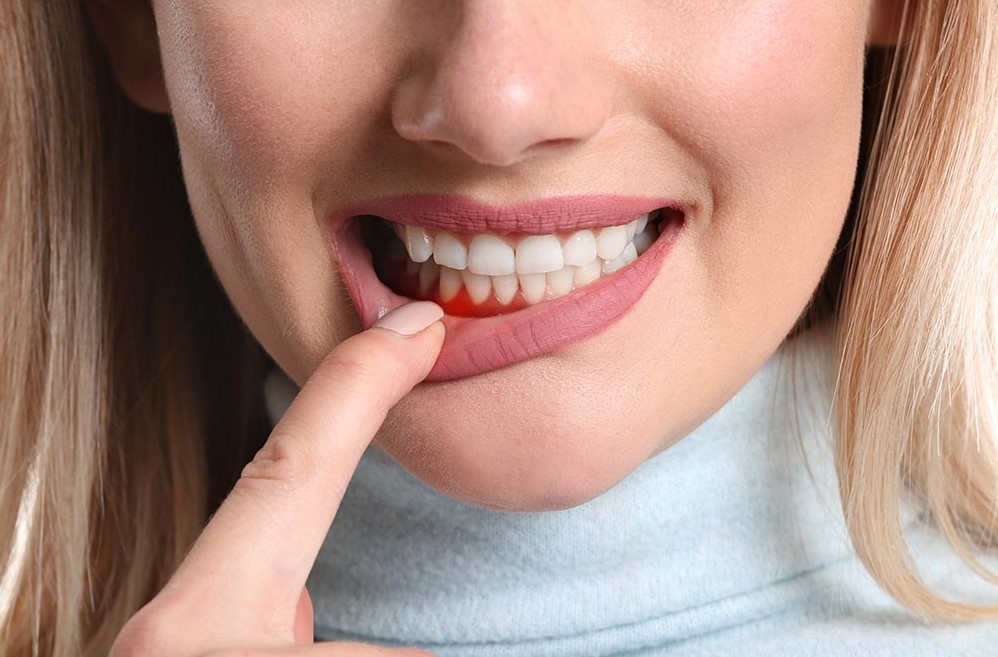 Parodontologija u Dental Timu Vuković
